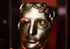 Racist slur shouted by a guest upended BAFTAs. We explain Tourette, medical condition behind outbursts
