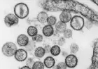 Suspected hantavirus outbreak on cruise ship kills 3, WHO says
