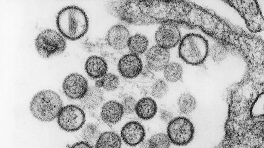 Suspected hantavirus outbreak on cruise ship kills 3, WHO says