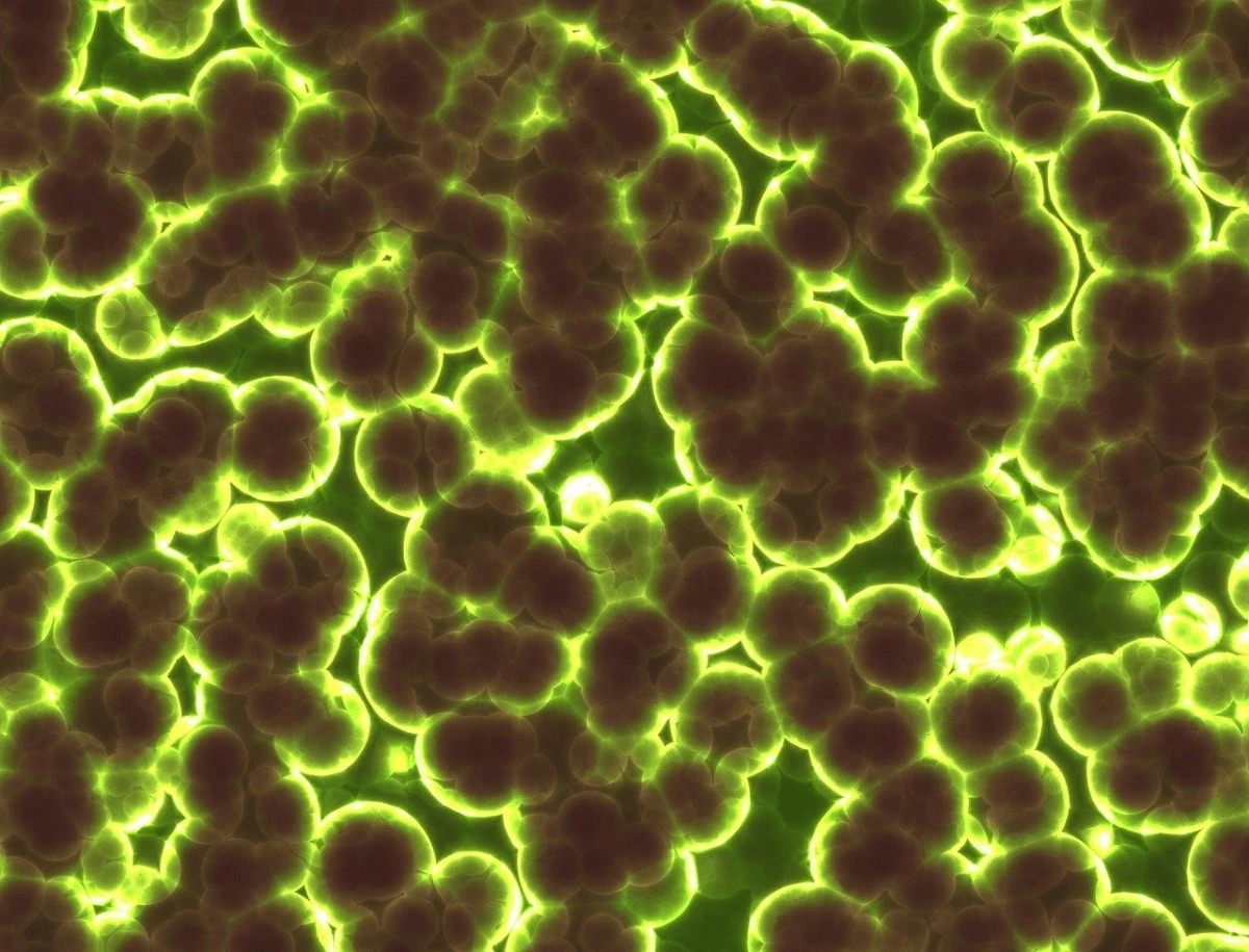 STUDIU: A fost descoperită o genă care ajută bacteriile intestinale dăunătoare să reziste la antibiotice şi dezinfectanţi
