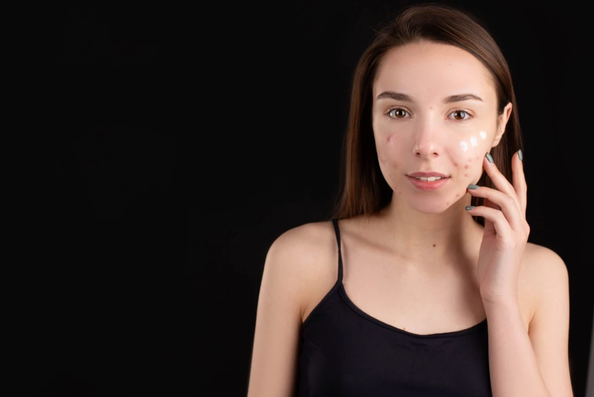 Rutina simplă de skincare de care adolescenții chiar au nevoie / Cinci sfaturi de la dermatologi