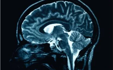 Leziunile cerebrale cauzate de Alzheimer ar putea fi reversibile, în urma unei noi descoperiri genetice